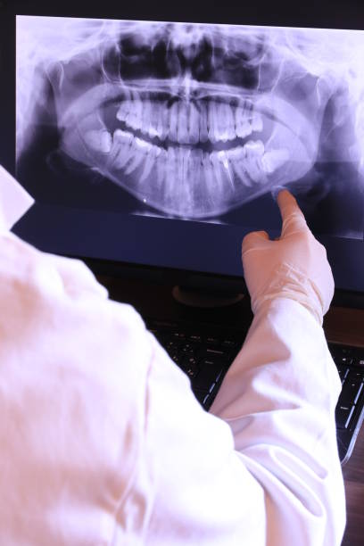 Best Emergency Tooth Extraction in Harrodsburg, KY
