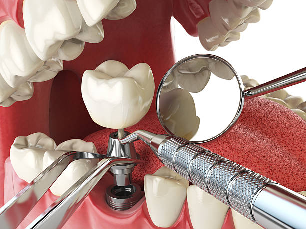 Best Pediatric Emergency Dentist in Harrodsburg, KY