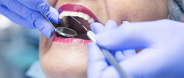 Best Emergency Wisdom Teeth Removal in Harrodsburg, KY